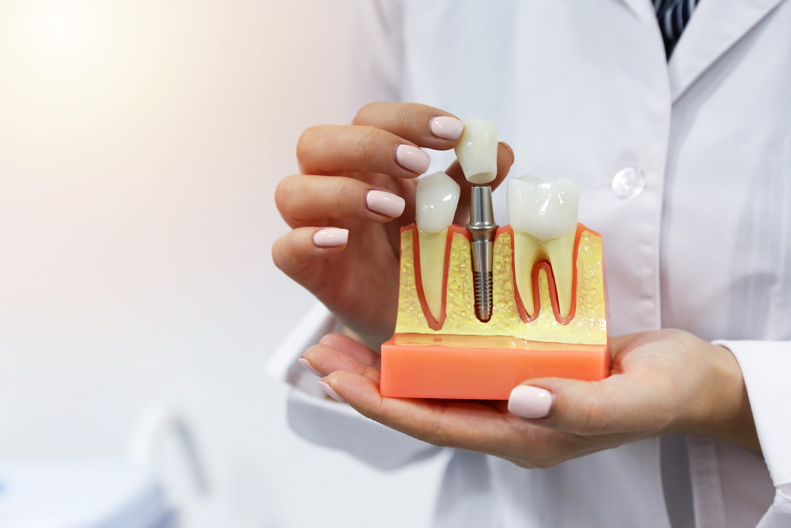 Dental,Concept.,The,Hands,Of,A,Dentist,Doctor,Hold,A