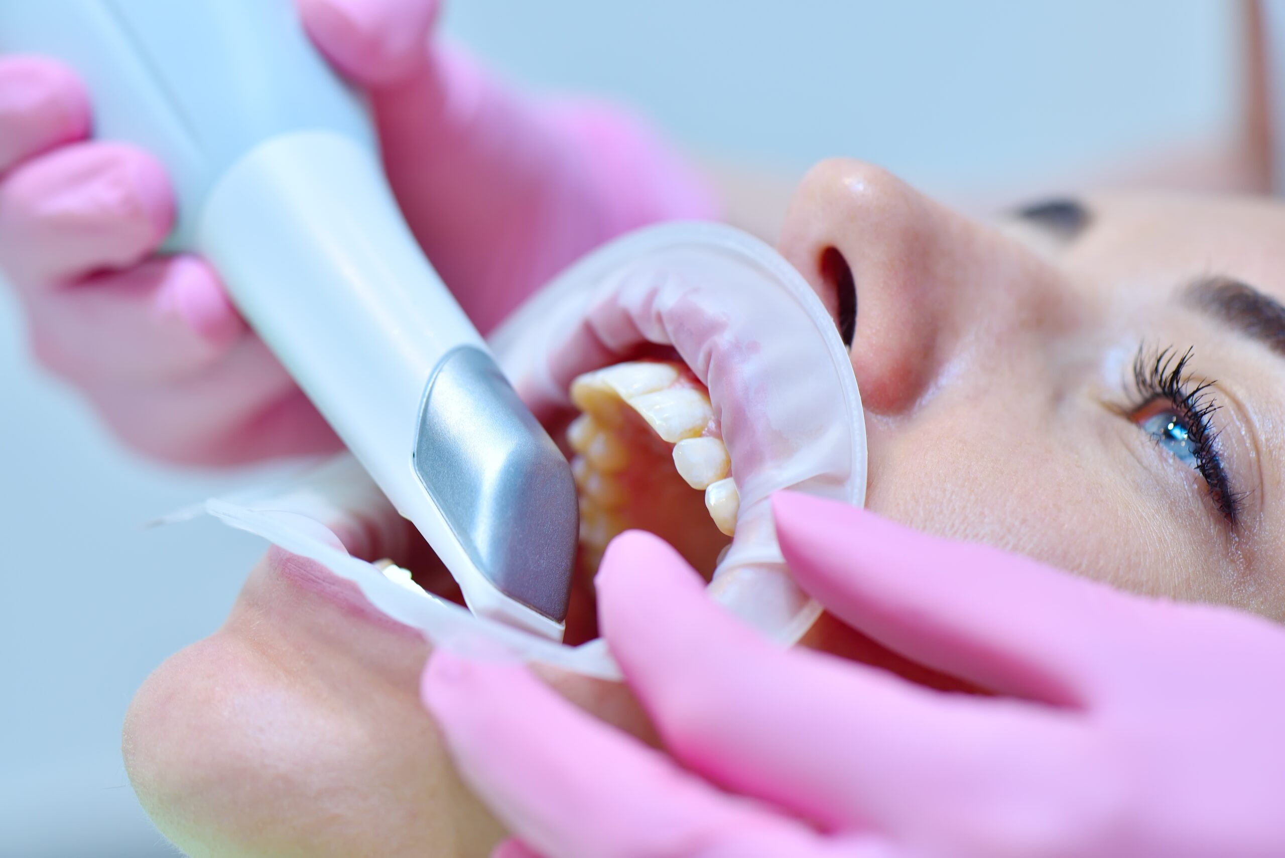 Orthodontist,Using,3d,Intraoral,Scanner,For,Scanning,Teeth,Patient's.,Modern