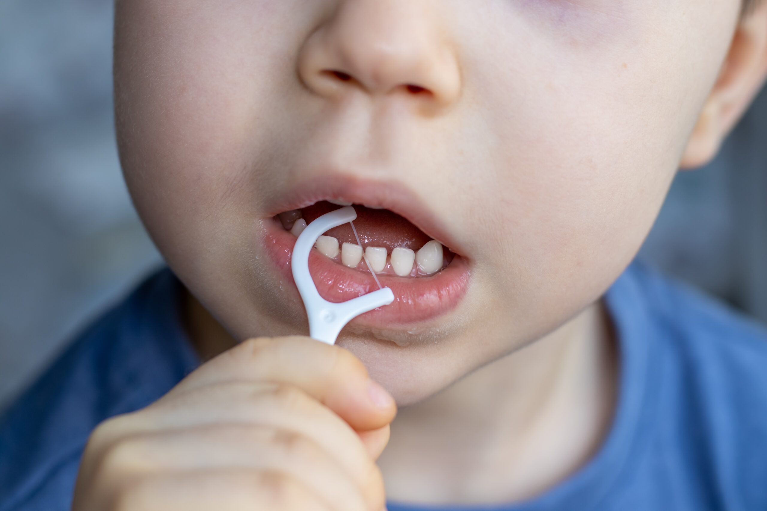 A,Boy,Is,Cleaning,His,Teeth,With,A,Toothpick.,Plastic