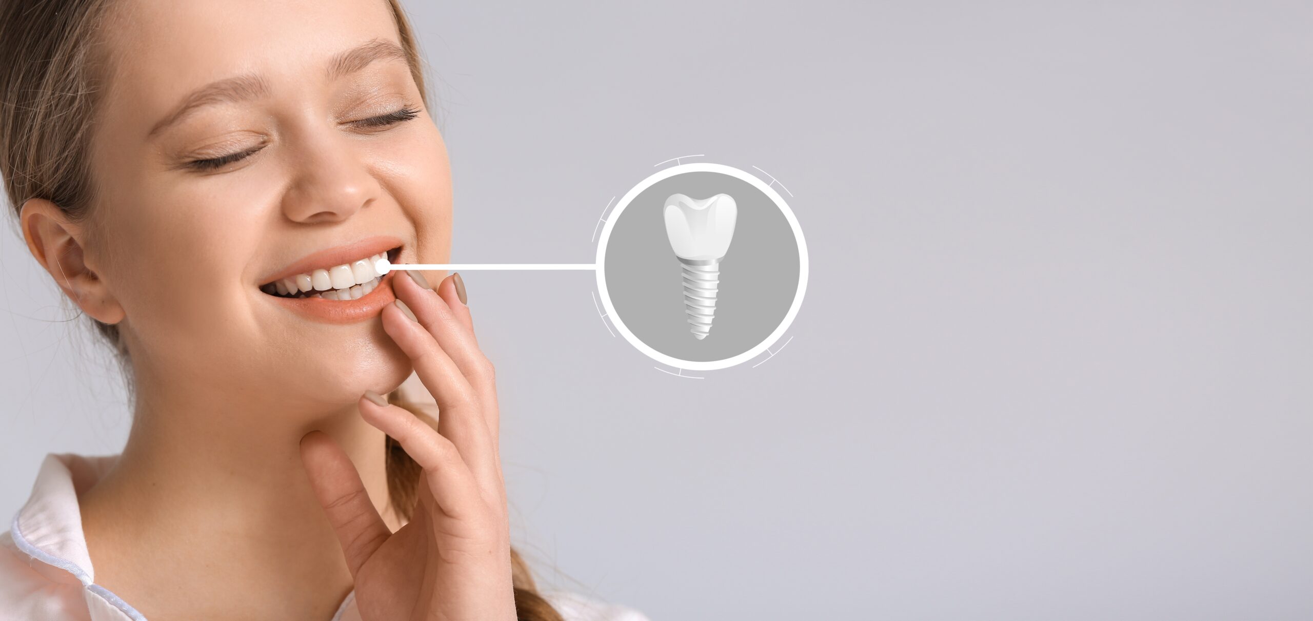 Smiling,Young,Woman,With,Implanted,Teeth,On,Light,Background